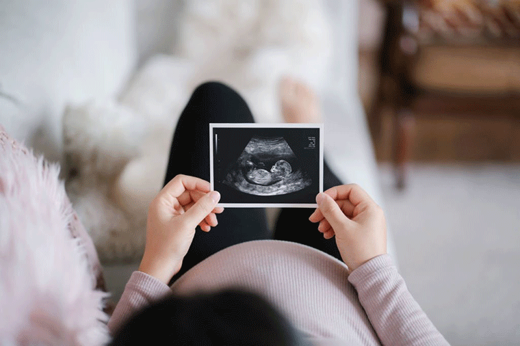 کم‌ کردن اضطراب بارداری و زایمان برای مادران بدون همسر